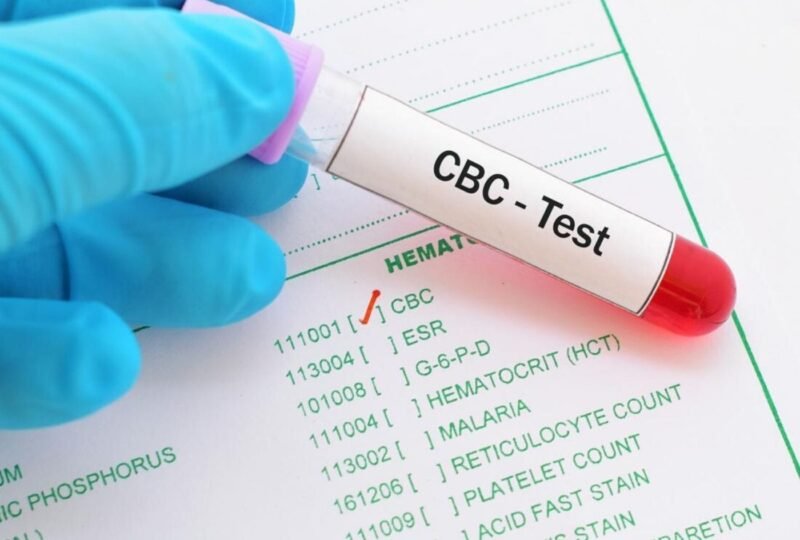 Complete Blood Picture (CBC) Test Cost in Hyderabad